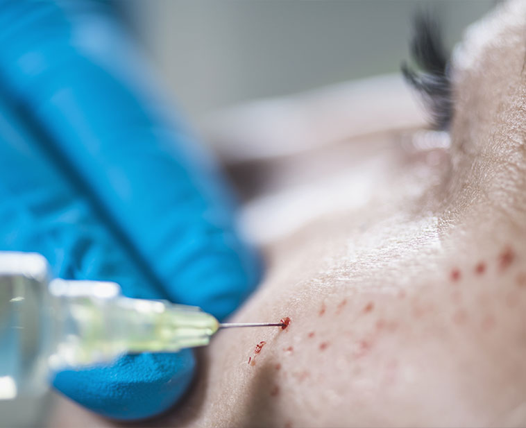 Agence web spécialisée dans votre domaine medico-esthetique